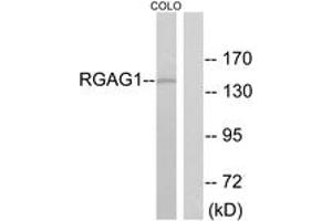 Western blot analysis of extracts from COLO cells, using RGAG1 Antibody. (RGAG1 抗体  (AA 1331-1380))