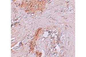 Immunohistochemical staining of human colon cells with RBM35A polyclonal antibody  at 2. (ESRP1 抗体  (N-Term))