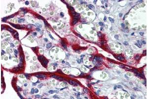 Human Placenta: Formalin-Fixed, Paraffin-Embedded (FFPE) (Fibrillin 1 抗体  (AA 2772-2872))