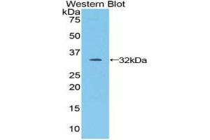 Western Blotting (WB) image for anti-Janus Kinase 1 (JAK1) (AA 596-841) antibody (ABIN3205083) (JAK1 抗体  (AA 596-841))