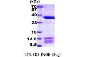 Mitochondrial Ribosomal Protein L1 (MRPL1) (AA 51-325) protein (His tag)