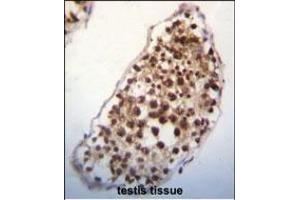 SNRK Antibody (Center) (ABIN652303 and ABIN2841382) immunohistochemistry analysis in formalin fixed and paraffin embedded human testis tissue followed by peroxidase conjugation of the secondary antibody and DAB staining. (SNRK 抗体  (AA 320-349))