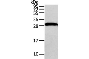 Western Blotting (WB) image for anti-VAMP (Vesicle-Associated Membrane Protein)-Associated Protein A, 33kDa (VAPA) antibody (ABIN5962090) (VAPA 抗体)