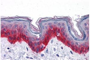 Human Skin: Formalin-Fixed, Paraffin-Embedded (FFPE) (KRT81 抗体  (AA 1-203))