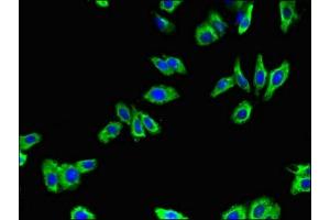 Immunofluorescent analysis of HepG2 cells using ABIN7145355 at dilution of 1:100 and Alexa Fluor 488-congugated AffiniPure Goat Anti-Rabbit IgG(H+L) (ADRB1 抗体  (AA 401-477))