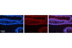 Human Bronchial Epithelial Tissue; Rabbit Anti-TRIM32 Antibody . (TRIM32 抗体  (C-Term))