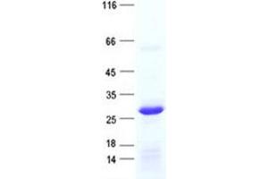 Western Blotting (WB) image for Ribosomal Protein L10L (RPL10L) protein (His tag) (ABIN2731123)