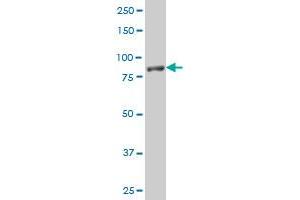 NLGN1 polyclonal antibody (A01), Lot # UTO6060209QCS1 Western Blot analysis of NLGN1 expression in Jurkat (Neuroligin 1 抗体  (AA 578-677))