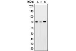 Western blot analysis of PKC theta (pS676) expression in HeLa UV-treated (A), SP2/0 UV-treated (B), PC12 UV-treated (C) whole cell lysates. (PKC theta 抗体  (C-Term, pSer676))