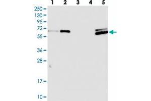 Western blot analysis of Lane 1: RT-4, Lane 2: U-251 MG, Lane 3: Human Plasma, Lane 4: Liver, Lane 5: Tonsil with CTDSPL2 polyclonal antibody  at 1:100-1:250 dilution.