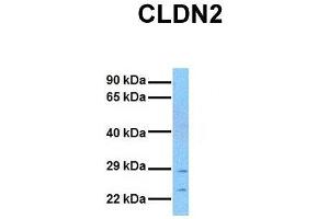 Host:  Rabbit  Target Name:  CLDN2  Sample Tissue:  Human MCF7  Antibody Dilution:  1. (Claudin 2 抗体  (N-Term))