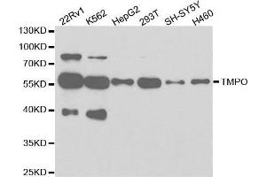 Western blot analysis of extracts of various cell lines, using TMPO antibody. (Thymopoietin 抗体  (AA 1-410))