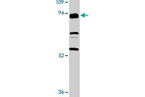 Western blot analysis of TLR3 expression in K-562 cell lysate with TLR3 polyclonal antibody  at 2 ug/mL . (TLR3 抗体  (N-Term))