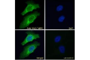ABIN185150 Immunofluorescence analysis of paraformaldehyde fixed HeLa cells, permeabilized with 0. (MPP5 抗体  (N-Term))