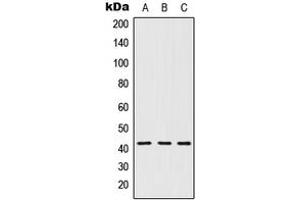 Western blot analysis of 5-HT1D expression in MCF7 (A), Raw264. (5HT1D 抗体  (Center))