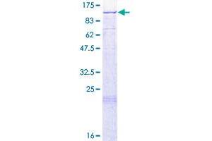 Leucyl-tRNA Synthetase 2, Mitochondrial (LARS2) (AA 1-903) protein (GST tag)