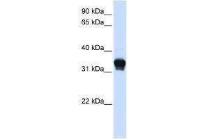 WB Suggested Anti-CSNK1A1 Antibody Titration: 0. (CSNK1A1 抗体  (C-Term))