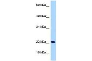 Image no. 1 for anti-Chromosome 9 Open Reading Frame 9 (C9ORF9) (AA 30-79) antibody (ABIN6748276) (C9orf9 抗体  (AA 30-79))