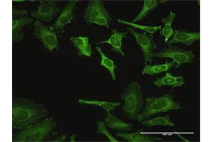 Immunofluorescence of purified MaxPab antibody to ZYX on HeLa cell. (ZYX 抗体  (AA 1-572))
