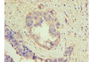 Immunohistochemistry (IHC) image for anti-ATP Synthase, H+ Transporting, Mitochondrial F1 Complex, beta Polypeptide (ATP5B) (AA 230-529) antibody (ABIN7144840)