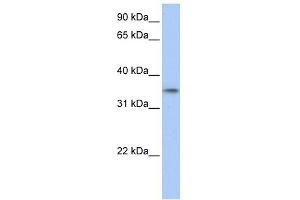 WB Suggested Anti-C17orf39 Antibody Titration: 0. (GID4 抗体  (C-Term))