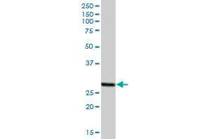 Western Blotting (WB) image for anti-Proteasome (Prosome, Macropain) Activator Subunit 2 (PA28 Beta) (PSME2) (AA 1-239) antibody (ABIN519418)