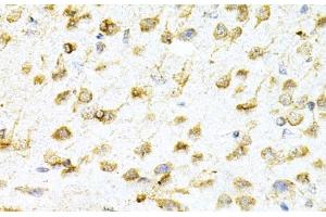 Immunohistochemistry (Paraffin-embedded Sections) (IHC (p)) image for anti-VAMP (Vesicle-Associated Membrane Protein)-Associated Protein B and C (VAPB) antibody (ABIN7261311)