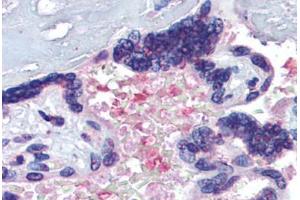 Placenta, serum, Human: Formalin-Fixed, Paraffin-Embedded (FFPE) (Hemopexin 抗体  (AA 32-45))