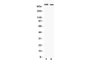 Western Blotting (WB) image for anti-Huntingtin (HTT) (C-Term) antibody (ABIN3031257)