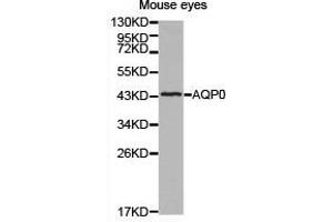 Western Blotting (WB) image for anti-Major Intrinsic Protein of Lens Fiber (MIP) antibody (ABIN1873696) (MIP 抗体)