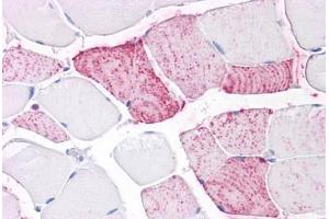 Immunohistochemistry (IHC) image for anti-Protein tyrosine Phosphatase, Receptor Type, A (PTPRA) (Extracellular Domain) antibody (ABIN1049272)