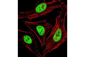 Fluorescent image of Hela cells stained with SBP Antibody (Center) C. (SAP30BP 抗体  (AA 160-188))