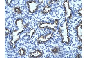 Immunohistochemistry (IHC) image for anti-Tripartite Motif Containing 13 (TRIM13) (Middle Region) antibody (ABIN2778286)