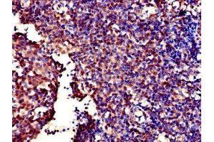 Immunohistochemistry (IHC) image for anti-Galactose-1-Phosphate Uridylyltransferase (GALT) (AA 1-379) antibody (ABIN7153422)