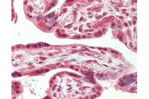 Immunohistochemistry (IHC) image for anti-Casein Kinase 2, alpha Prime Polypeptide (CSNK2A2) (AA 300-350), (C-Term) antibody (ABIN2619592)