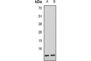 Western blot analysis of AHSP expression in mouse liver (A), rat liver (B) whole cell lysates. (aHSP 抗体)