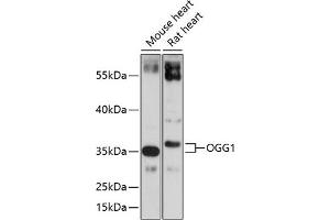 Western blot analysis of extracts of various cell lines, using OGG1 antibody (ABIN3021936, ABIN3021937, ABIN3021938 and ABIN6217976) at 1:1000 dilution. (OGG1 抗体  (AA 1-345))