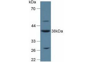 Detection of ANXA2 in Rat Placenta Tissue using Polyclonal Antibody to Annexin A2 (ANXA2) (Annexin A2 抗体  (AA 1-339))