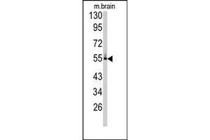 anti-Cytochrome P450, Family 26, Subfamily C, Polypeptide 1 (CYP26C1) (C-Term) antibody