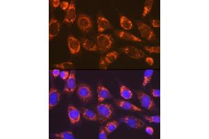 Immunofluorescence analysis of NIH-3T3 cells using Smac/Diablo Rabbit mAb (ABIN7270177) at dilution of 1:100 (40x lens). (DIABLO 抗体)