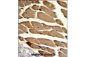 Formalin-fixed and paraffin-embedded human skeletal muscle reacted with ACTR2 Antibody , which was peroxidase-conjugated to the secondary antibody, followed by DAB staining. (ACTR2 抗体  (AA 191-219))