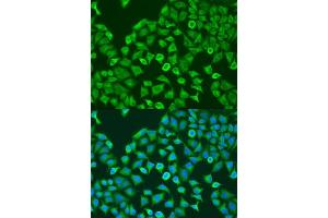 Immunofluorescence analysis of U2OS cells using Pumilio 1 antibody  at dilution of 1:100. (PUM1 抗体  (AA 1-280))