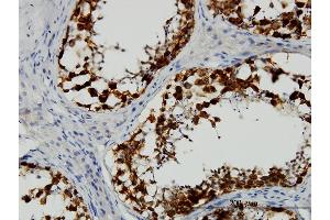 Immunoperoxidase of monoclonal antibody to DAZ1 on formalin-fixed paraffin-embedded human testis. (DAZ1 抗体  (AA 21-120))