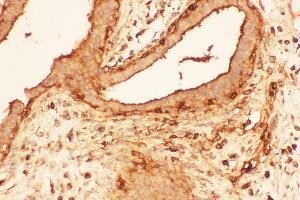 Immunohistochemistry (IHC) image for anti-Cofilin 1 (CFL1) (AA 2-166) antibody (ABIN3042747)