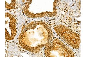 ABIN6262635 and ABIN6273051 at 1/100 staining Human normal tissues adjacent to breast cancer by IHC-P. (Importin 4 抗体  (Internal Region))