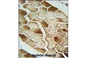 SAR1B antibody (Center) (ABIN654355 and ABIN2844120) immunohistochemistry analysis in formalin fixed and paraffin embedded human skeletal muscle followed by peroxidase conjugation of the secondary antibody and DAB staining. (SAR1B 抗体  (AA 89-116))