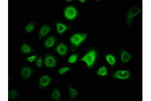 Immunofluorescence staining of A549 cells with ABIN7176339 at 1:166, counter-stained with DAPI. (ZNF488 抗体  (AA 1-200))