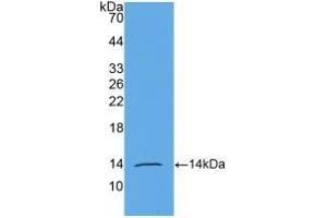 Detection of Recombinant AMH, Human using Monoclonal Antibody to Anti-Mullerian Hormone (AMH) (AMH 抗体  (AA 453-560))