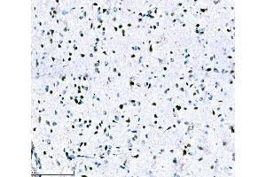 IHC analysis of ADAR1/ADAR using anti-ADAR1/ADAR antibody (ABIN7598956). (ADAR 抗体  (AA 1-1152))