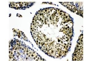 IHC analysis of KDM5B using anti-KDM5B antibody (ABIN4886648).